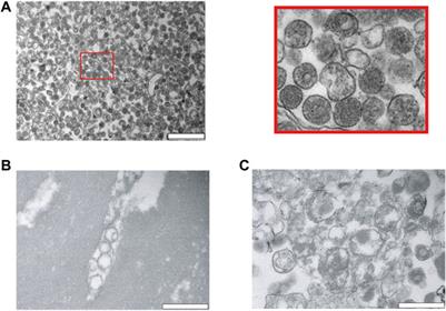 Validation of Effective Extracellular Vesicles Isolation Methods Adapted to Field Studies in Malaria Endemic Regions